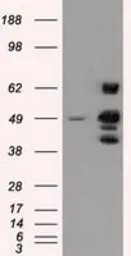 Anti-PSMC3 antibody [9F3] used in Western Blot (WB). GTX83778