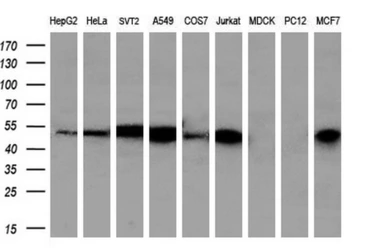 Anti-PSMC3 antibody [9G5] used in Western Blot (WB). GTX83783