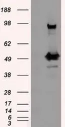 Anti-PSMC3 antibody [1C10] used in Western Blot (WB). GTX83784