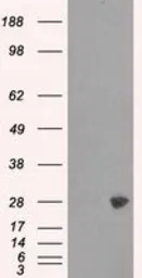 Anti-PSMA7 antibody [8F9] used in Western Blot (WB). GTX83785