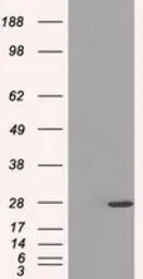 Anti-PSMA7 antibody [2A7] used in Western Blot (WB). GTX83786