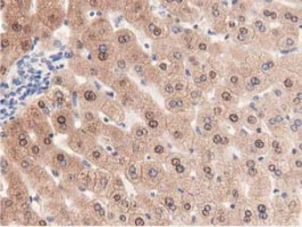Anti-PRPSAP2 antibody [1E3] used in IHC (Paraffin sections) (IHC-P). GTX83790