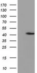 Anti-PRPSAP2 antibody [1E3] used in Western Blot (WB). GTX83790