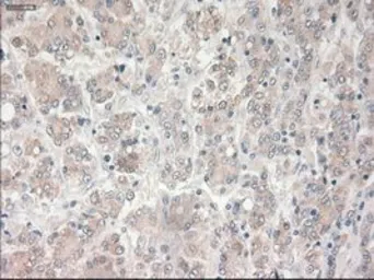 Anti-PROM2 antibody [14D1] used in IHC (Paraffin sections) (IHC-P). GTX83792
