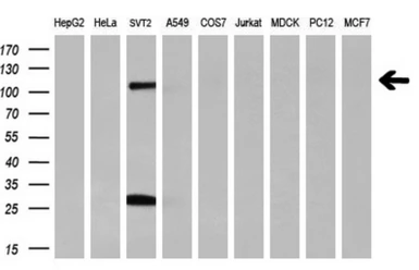 Anti-PROM2 antibody [14D1] used in Western Blot (WB). GTX83792