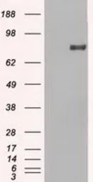 Anti-PROM2 antibody [14D1] used in Western Blot (WB). GTX83792