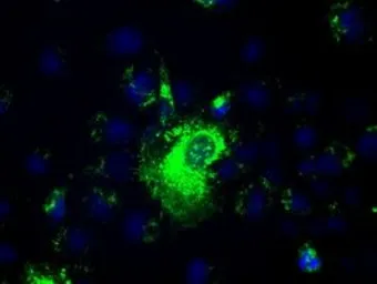 Anti-PROM2 antibody [14D1] used in Immunocytochemistry/ Immunofluorescence (ICC/IF). GTX83792