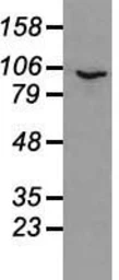 Anti-PROM2 antibody [3D12] used in Western Blot (WB). GTX83794
