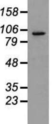 Anti-PROM2 antibody [3D12] used in Western Blot (WB). GTX83794