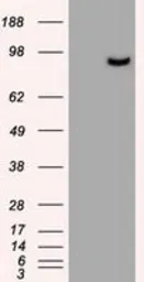 Anti-PROM2 antibody [5E5] used in Western Blot (WB). GTX83797