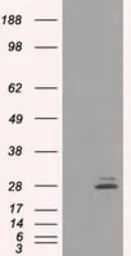 Anti-Prolactin antibody [6B1] used in Western Blot (WB). GTX83802