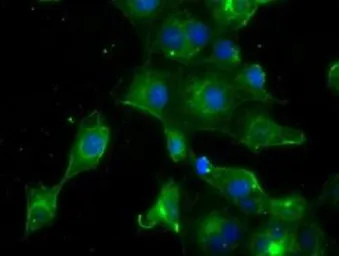 Anti-Prolactin antibody [6B1] used in Immunocytochemistry/ Immunofluorescence (ICC/IF). GTX83802