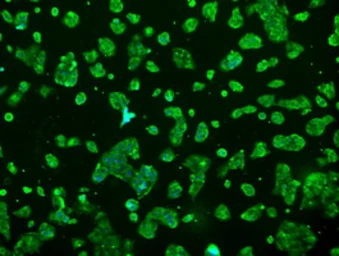 Anti-Prolactin antibody [6B1] used in Immunocytochemistry/ Immunofluorescence (ICC/IF). GTX83802