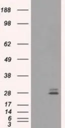 Anti-Prolactin antibody [9D12] used in Western Blot (WB). GTX83803