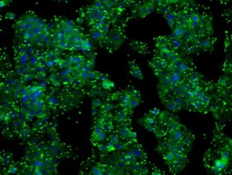 Anti-Prolactin antibody [9D12] used in Immunocytochemistry/ Immunofluorescence (ICC/IF). GTX83803