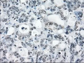 Anti-PRKY antibody [2H9] used in IHC (Paraffin sections) (IHC-P). GTX83804