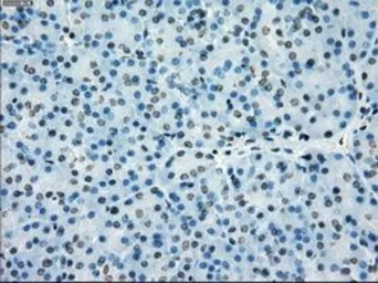 Anti-PRKY antibody [2H9] used in IHC (Paraffin sections) (IHC-P). GTX83804