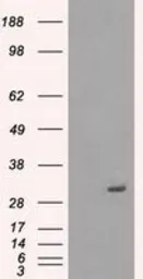 Anti-PRKY antibody [2H9] used in Western Blot (WB). GTX83804