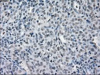 Anti-PRKY antibody [3E10] used in IHC (Paraffin sections) (IHC-P). GTX83810