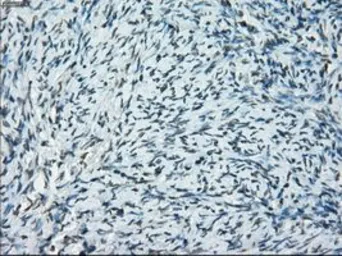 Anti-PRKY antibody [3E10] used in IHC (Paraffin sections) (IHC-P). GTX83810