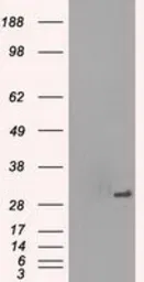 Anti-PRKY antibody [3E10] used in Western Blot (WB). GTX83810