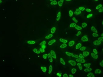 Anti-PRKY antibody [3E10] used in Immunocytochemistry/ Immunofluorescence (ICC/IF). GTX83810