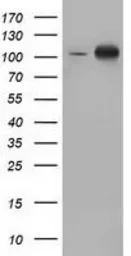 Anti-PKD2 antibody [5G1] used in Western Blot (WB). GTX83817