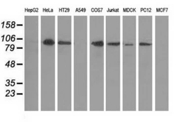 Anti-PKD2 antibody [5G1] used in Western Blot (WB). GTX83817