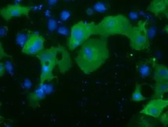 Anti-PKD2 antibody [5G1] used in Immunocytochemistry/ Immunofluorescence (ICC/IF). GTX83817