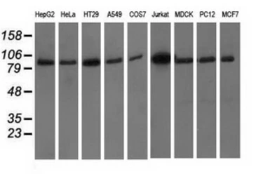 Anti-PKD2 antibody [3B12] used in Western Blot (WB). GTX83819