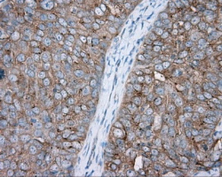 Anti-PKA R2 antibody [1A7] used in IHC (Paraffin sections) (IHC-P). GTX83823