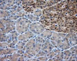 Anti-PKA R2 antibody [1A7] used in IHC (Paraffin sections) (IHC-P). GTX83823