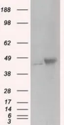 Anti-PKA R2 antibody [1A7] used in Western Blot (WB). GTX83823