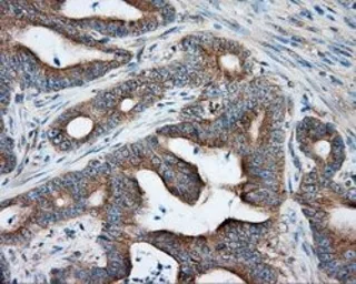 Anti-PKA R2 antibody [4A3] used in IHC (Paraffin sections) (IHC-P). GTX83825