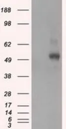 Anti-PKA R2 antibody [4A3] used in Western Blot (WB). GTX83825