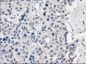 Anti-PKA I alpha reg antibody [6C7] used in IHC (Paraffin sections) (IHC-P). GTX83827