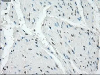 Anti-PKA I alpha reg antibody [6C7] used in IHC (Paraffin sections) (IHC-P). GTX83827