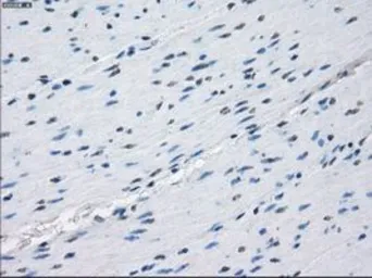 Anti-PKA I alpha reg antibody [6C7] used in IHC (Paraffin sections) (IHC-P). GTX83827