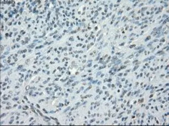 Anti-PKA I alpha reg antibody [6C7] used in IHC (Paraffin sections) (IHC-P). GTX83827