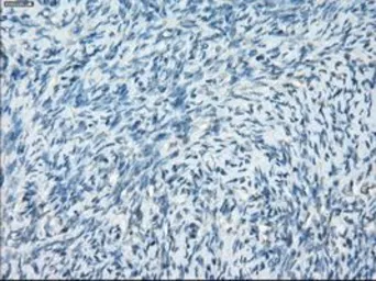 Anti-PKA I alpha reg antibody [6C7] used in IHC (Paraffin sections) (IHC-P). GTX83827