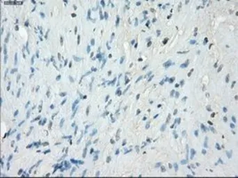 Anti-PKA I alpha reg antibody [6C7] used in IHC (Paraffin sections) (IHC-P). GTX83827