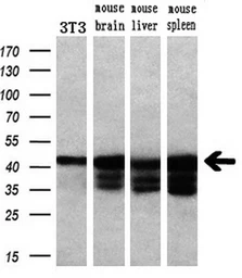 Anti-PKA I alpha reg antibody [6C7] used in Western Blot (WB). GTX83827