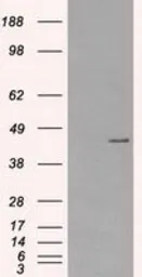 Anti-PKA I alpha reg antibody [6C7] used in Western Blot (WB). GTX83827