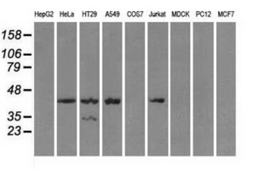 Anti-PKA I alpha reg antibody [6C7] used in Western Blot (WB). GTX83827