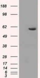 Anti-PPP5C antibody [2E12] used in Western Blot (WB). GTX83832