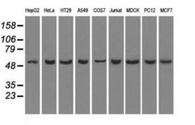 Anti-PPP5C antibody [2E12] used in Western Blot (WB). GTX83832