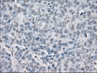 Anti-PPP5C antibody [5G5] used in IHC (Paraffin sections) (IHC-P). GTX83840