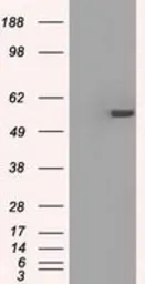 Anti-PPP5C antibody [5G5] used in Western Blot (WB). GTX83840