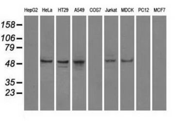 Anti-PPP5C antibody [5G5] used in Western Blot (WB). GTX83840