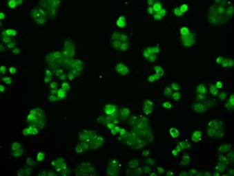 Anti-PPP5C antibody [5G5] used in Immunocytochemistry/ Immunofluorescence (ICC/IF). GTX83840